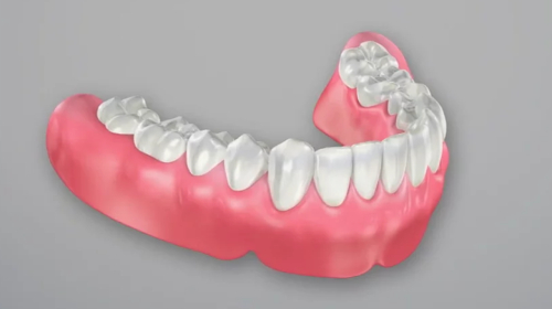complete-full-denture